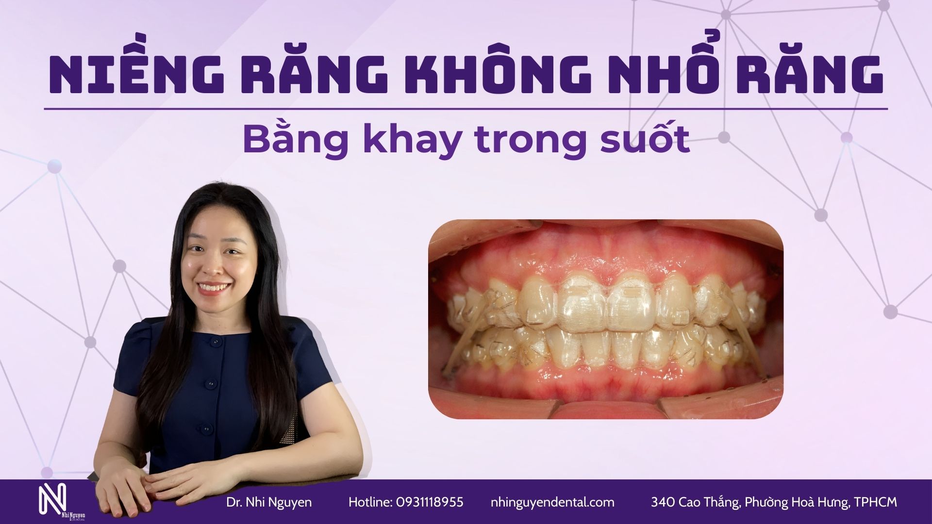 nieng rang khong nho rang