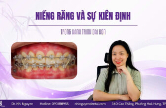 Niềng răng kiên định