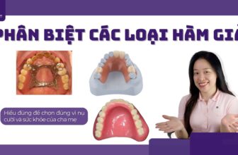 phan biet cac loai ham gia