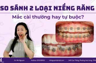 so sanh 2 loai nieng rang