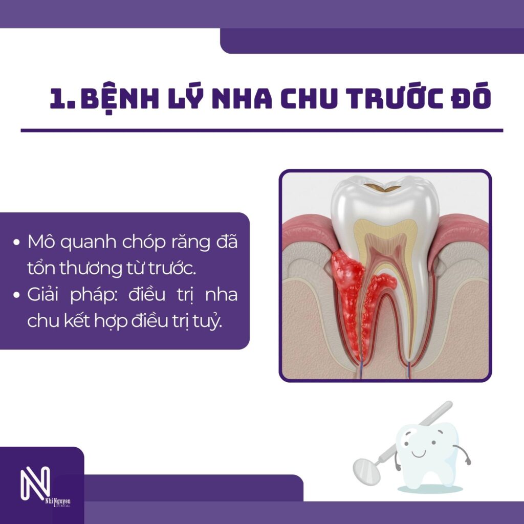 lay tuy xong van dau do benh nha chu truoc do