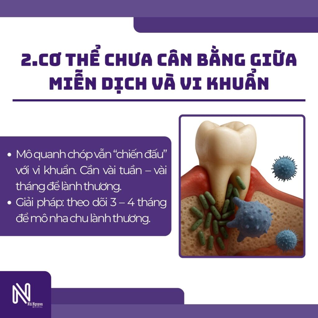 lay tuy xong van dau do chua can bang giua mien dich va vi khuan