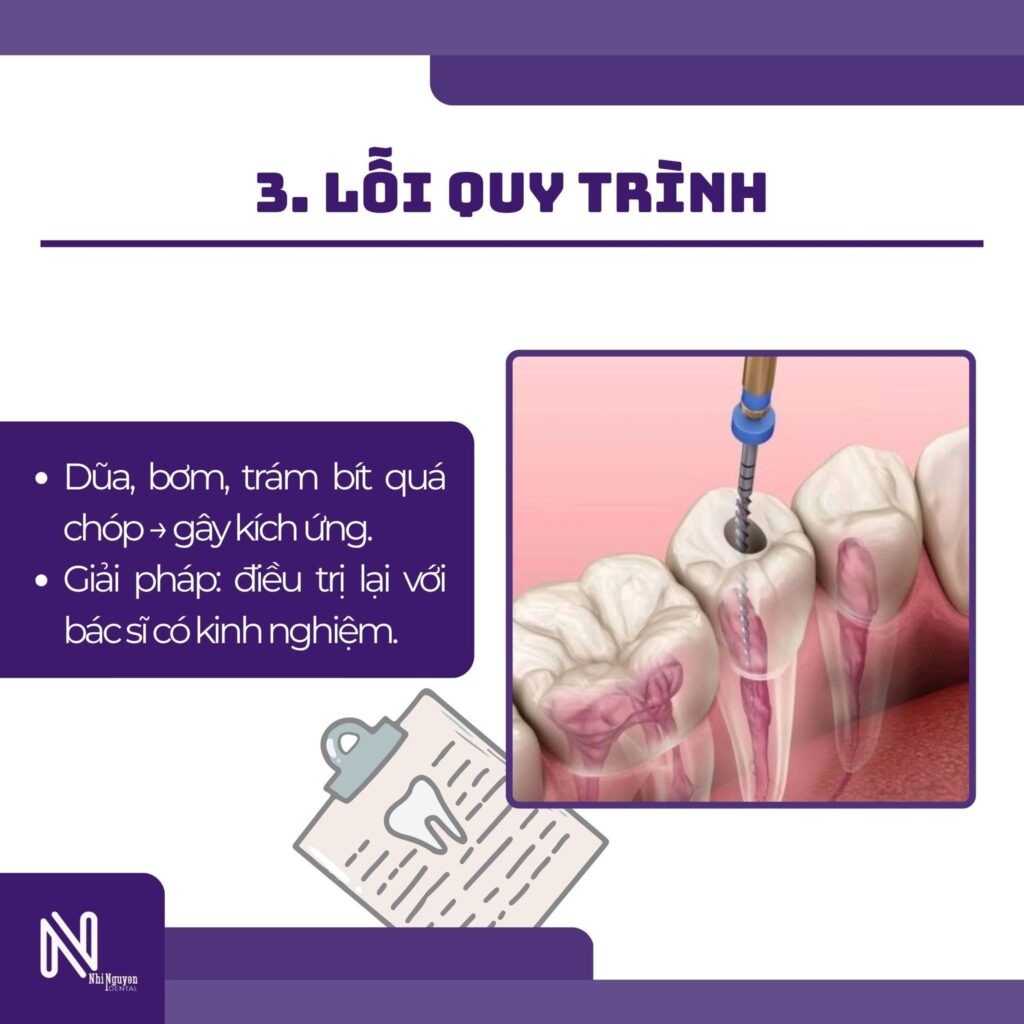 lay tuy xong van dau do loi quy trinh