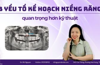 3 yeu to ke hoach nieng rang