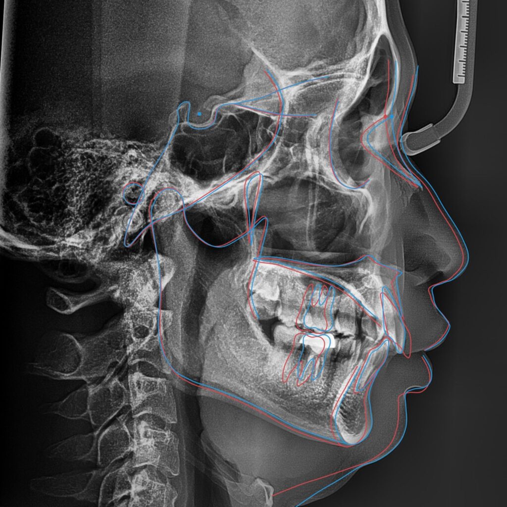 vai tro ke hoach nieng rang