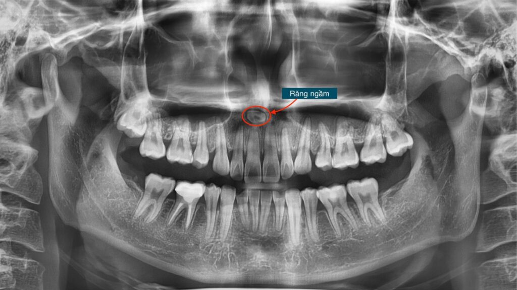 vai tro ke hoach nieng rang