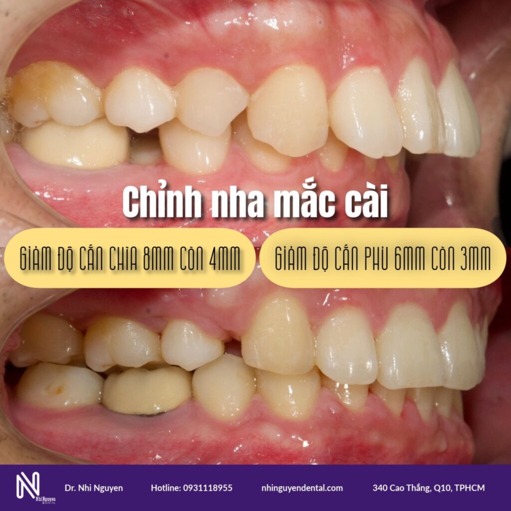 vai tro ke hoach nieng rang