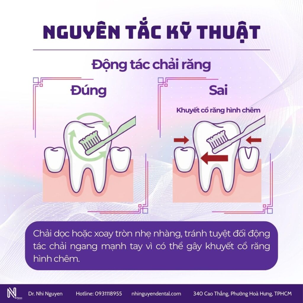 Ve sinh rang mieng ki thuat chai rang