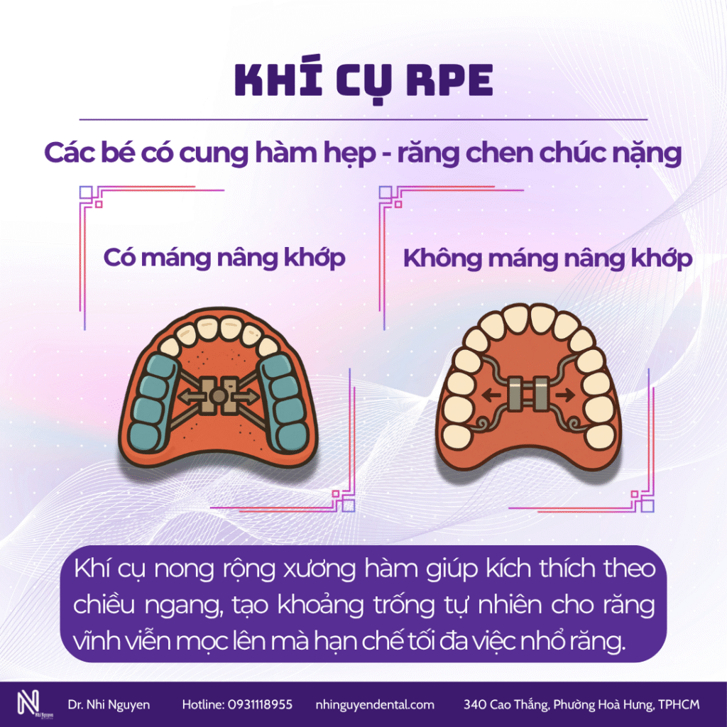 Khí cụ RPE