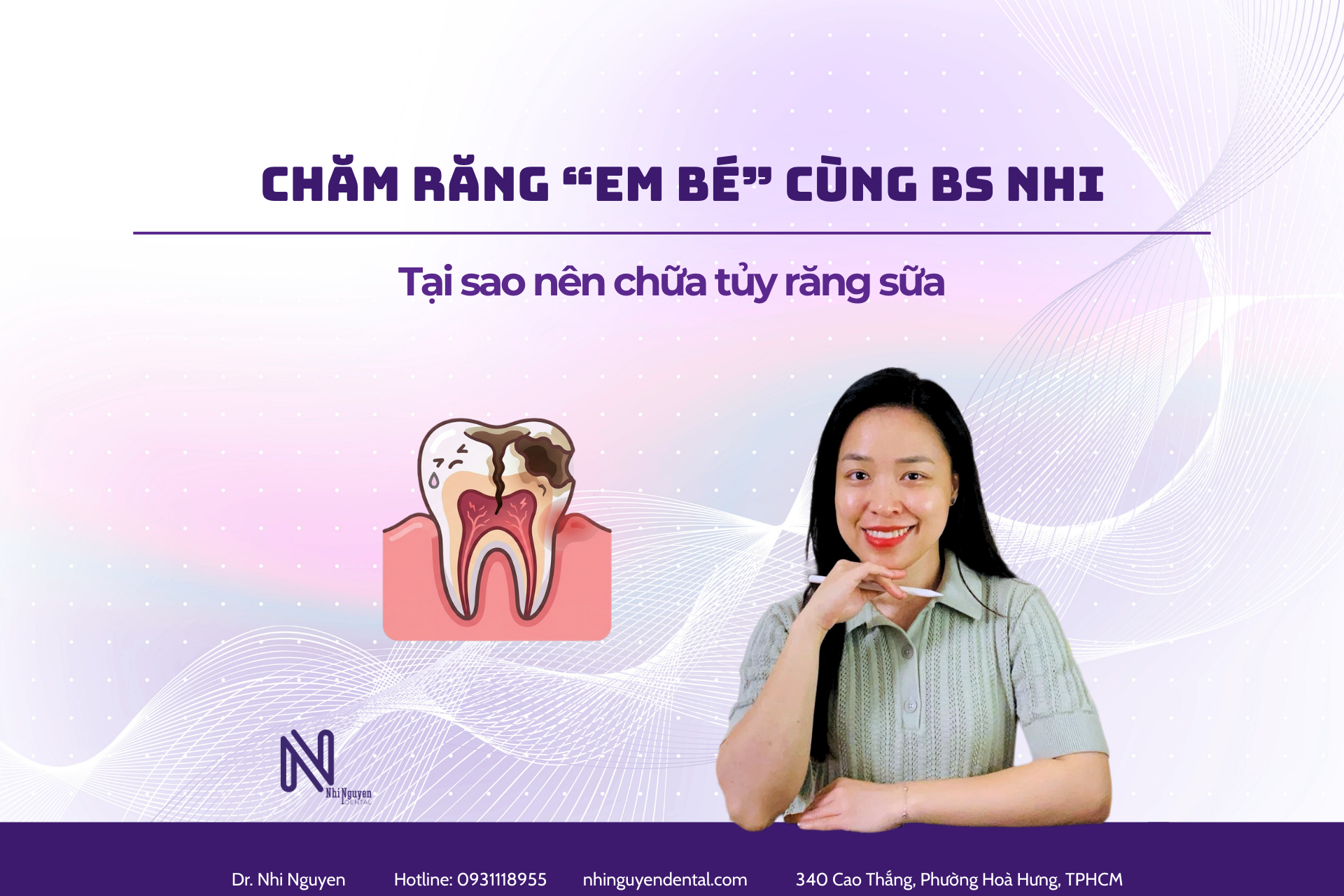 Chữa tuỷ răng sữa
