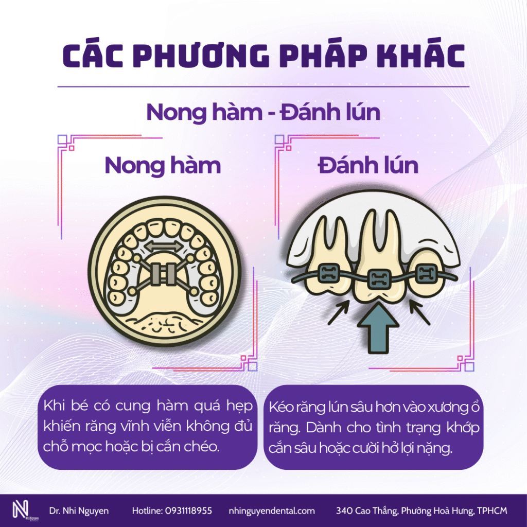 Nong hàm Đánh lún