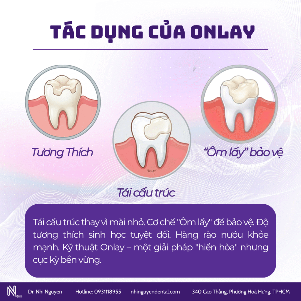 Tác dụng của onlay