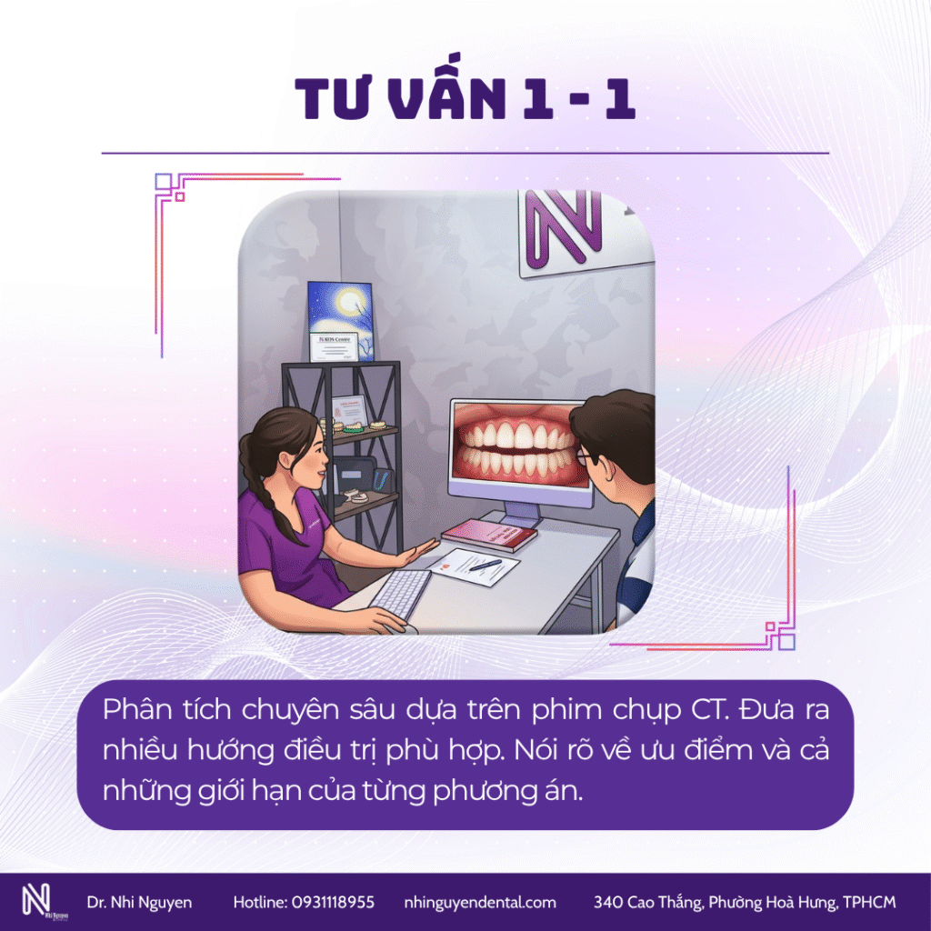 Tư vấn quá trình niềng răng 1-1
