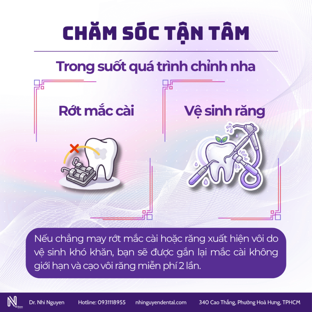 Quá trình niềng răng tận tâm
