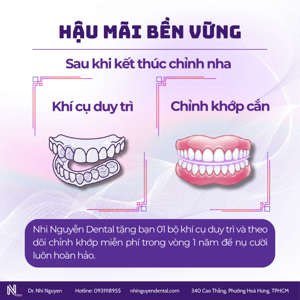 Quá trình niềng răng kết thúc. Hậu mãi bền vững