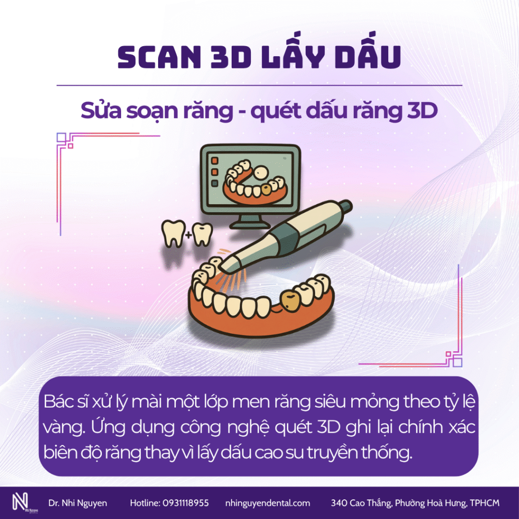 Phục hình răng sứ: scan lấy dấu