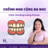 4 kỹ thuật niềng răng quyết định sự thay đổi của nụ cười