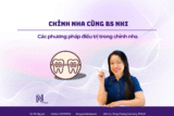 4 kỹ thuật niềng răng quyết định sự thay đổi của nụ cười