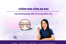 4 kỹ thuật niềng răng quyết định sự thay đổi của nụ cười