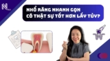 Nhổ răng nhanh gọn – Có thật sự tốt hơn lấy tủy?
