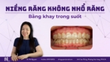 Niềng răng không nhổ răng bằng khay trong suốt – Giải pháp thẩm mỹ hiện đại
