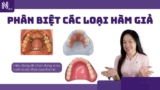 Phân biệt 3 loại hàm tháo lắp: Hàm khung – Hàm nhựa – Toàn hàm