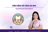 5 bước trong quy trình phục hình răng sứ cùng Bác sĩ Nhi