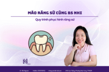 5 bước trong quy trình phục hình răng sứ cùng Bác sĩ Nhi