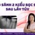 Nhổ răng nhanh gọn – Có thật sự tốt hơn lấy tủy?